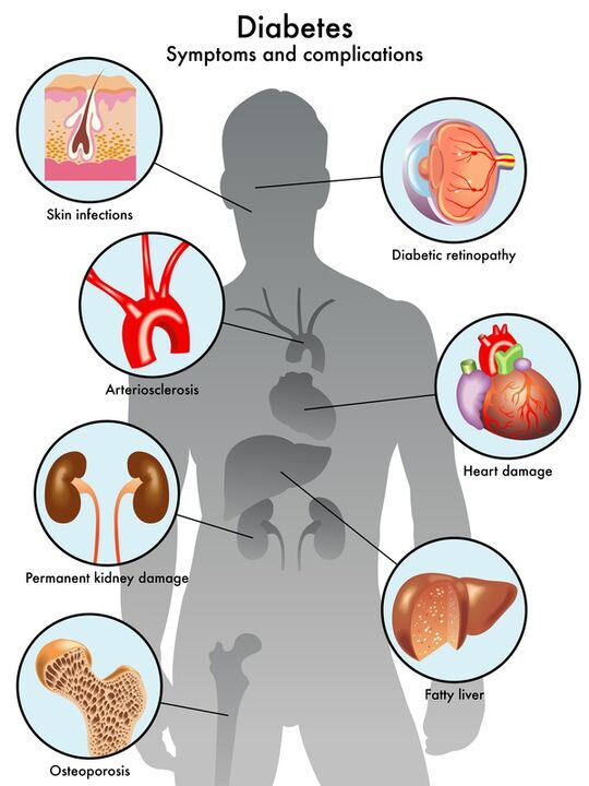 Insuvit protexe os órganos obxectivo das complicacións
